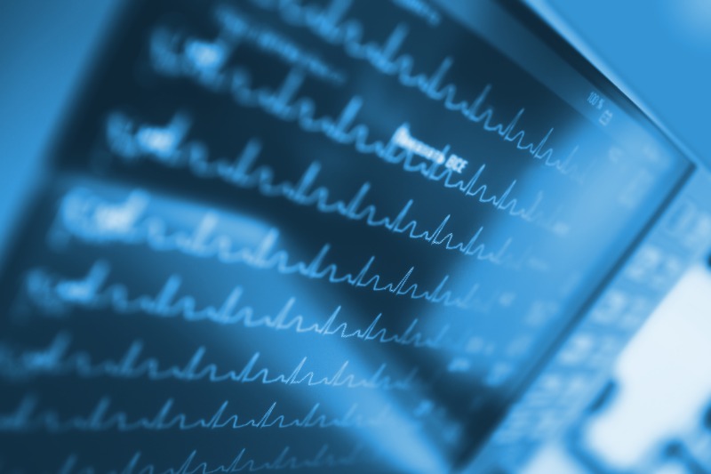 sepsis malpractice settlements